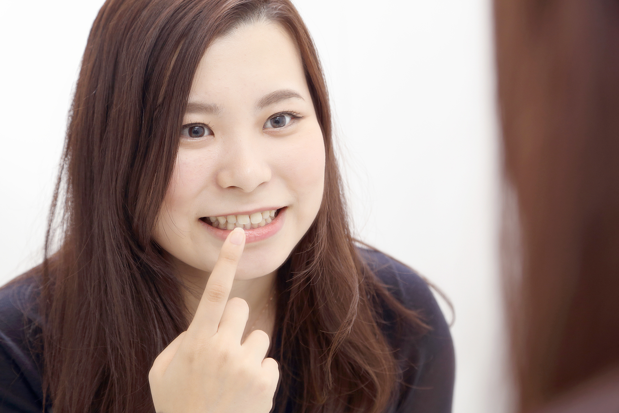 当院の審美歯科治療について