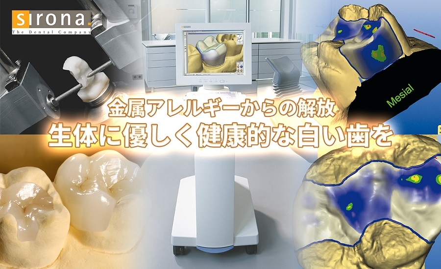 セレックとは
