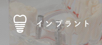 インプラント